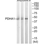Western blot analysis of extracts from A549, HepG2 and Jurkat cells, using PDHA1 antibody.