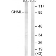Western blot analysis of extracts from COLO cells, using CHML antibody.
