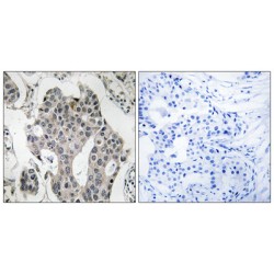 RAB3 GTPase Activating Non-Catalytic Protein Subunit 2 (RAB3GAP2) Antibody