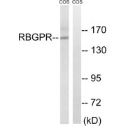 RAB3 GTPase Activating Non-Catalytic Protein Subunit 2 (RAB3GAP2) Antibody