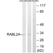 Western blot analysis of extracts from HuvEc, 293 and COLO205 cells, using RABL2A antibody.