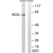 Western blot analysis of extracts from HuvEc cells, using RDX antibody.