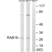Western blot analysis of extracts from HuvEc cells and MCF-7 cells, using RAB18 antibody.