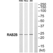 Western blot analysis of extracts from K562 cells, HeLa cells and 293 cells, using RAB2B antibody.