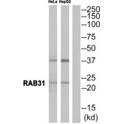 Western blot analysis of extracts from HeLa cells and HepG2 cells, using RAB31 antibody.