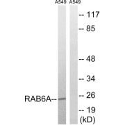 abx014800