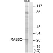 Western blot analysis of extracts from COLO cells, using RAB6C antibody.