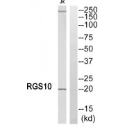 Western blot analysis of extracts from Jurkat cells, using RGS10 antibody.