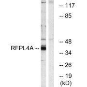 Western blot analysis of extracts from HUVEC cells, using RFPL4A antibody.