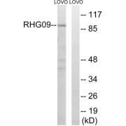 abx014819