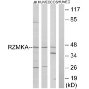 Western blot analysis of extracts from Jurkat cells, HuvEc cells and COS cells, using RIMKA antibody.