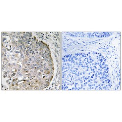 Mitochondrial Ribosome Recycling Factor (MRRF) Antibody