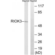 Western blot analysis of extracts from HepG2 cells, using RIOK3 antibody.