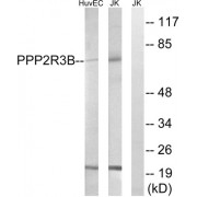 Western blot analysis of extracts from HuvEc cells and Jurkat cells, using PPP2R5D antibody.