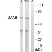 Western blot analysis of extracts from Jurkat cells and HeLa cells, using PPP2R1B antibody.