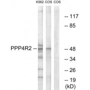 Western blot analysis of extracts from K562 cells and COS-7 cells, using PP4R2 antibody.