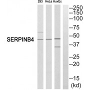 Western blot analysis of extracts from 293 cells, HeLa cells and HuvEc cells, using SERPINB4 antibody.