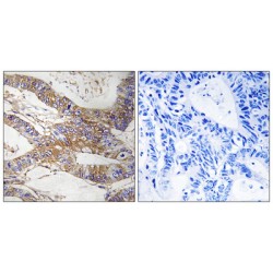 Serpin B9 (SERPINB9) Antibody