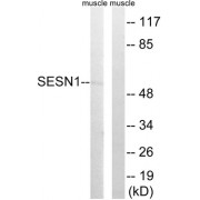 Western blot analysis of extracts from rat muscle cells, using SESN1 antibody.