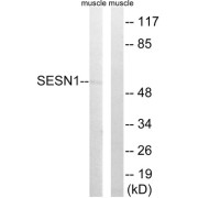 Western blot analysis of extracts from rat muscle cells, using SESN1 antibody.