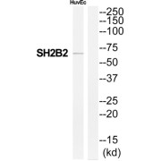 SH2B Adaptor Protein 2 (SH2B2) Antibody