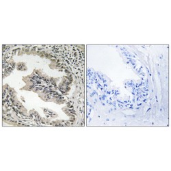 SH3 Domain Containing GRB2 Like, Endophilin B2 (SH3GLB2) Antibody