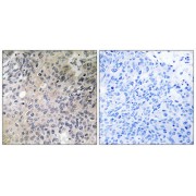 Immunohistochemistry analysis of paraffin-embedded human lung tissue using SHC3 antibody.