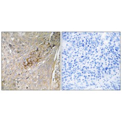 Sodium- and Chloride-Dependent Taurine Transporter (SLC6A6) Antibody