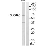 Western blot analysis of extracts from COLO205 cells, using SC6A6 antibody.
