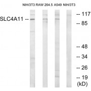 Western blot analysis of extracts from 3T3 cells, RAW264.7 cells and A549 cells, using SLC4A11 antibody.