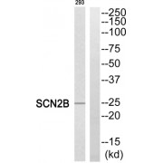 Western blot analysis of extracts from 293 cells, using SCN2B antibody.