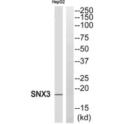Western blot analysis of extracts from HepG2 cells, using SNX3 antibody.