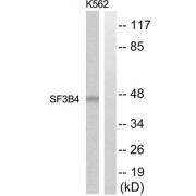 Western blot analysis of extracts from K562 and Jurkat cells, using SF3B4 antibody.