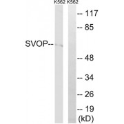 Western blot analysis of extracts from K562 cells, using SVOP antibody.