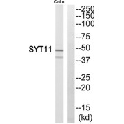 Western blot analysis of extracts from COLO205 cells, using SYT11 antibody.