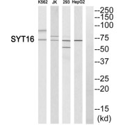 Western blot analysis of extracts from K562 cells, Jurkat cells, 293 cells and HepG2 cells, using SYT16 antibody.