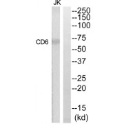 Western blot analysis of extracts from Jurkat cells, using CD6 antibody.