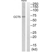 Western blot analysis of extracts from HepG2 cells, using CCT5 antibody.