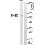 Western blot analysis of extracts from K562 cells, using THBD antibody.