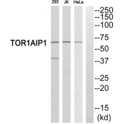 Western blot analysis of extracts from 293 cells, Jurkat cells and HeLa cells, using TOR1AIP1 antibody.