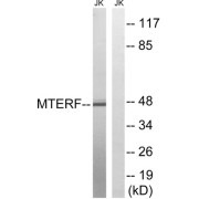 Western blot analysis of extracts from Jurkat cells, using MTERF antibody.