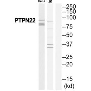 Protein Tyrosine Phosphatase, Non Receptor Type 22 (PTPN22) Antibody