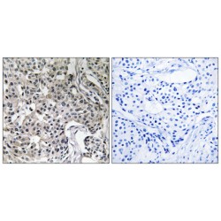 Ubiquitin Specific Peptidase 19 (USP19) Antibody