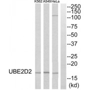 Western blot analysis of extracts from HeLa cells, A549 cells and K562 cells, using UBE2D2 antibody.