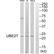 Western blot analysis of extracts from HeLa cells, Jurkat cells and K562 cells, using UBE2T antibody.