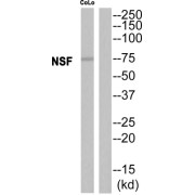 Western blot analysis of extracts from CoLo cells, using NSF antibody.