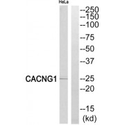 Western blot analysis of extracts from HeLa cells, using CACNG1 antibody.