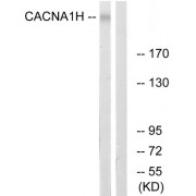 Western blot analysis of extracts from A549 cells, using CACNA1H antibody.