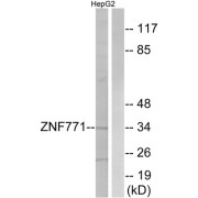 Western blot analysis of extracts from HepG2 cells, using ZNF771 antibody.