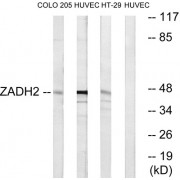 Western blot analysis of extracts from COLO cells, HUVEC cells and HT-29 cells, using ZADH2 antibody.